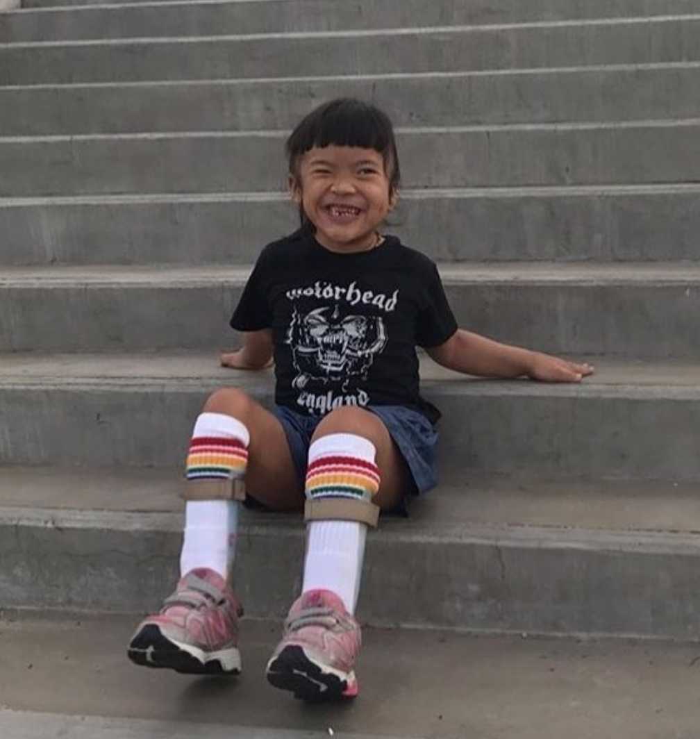 Lifestyle image of Fearless rainbow striped socks for kids wearing leg braces